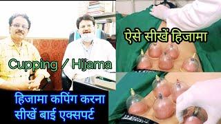 hijama  / cupping / हिजामा यानी कपिंग करना कैसे सीखें एक्सपर्ट के जरिए  hijama cupping bhai expert