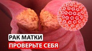 Мазок на цитологию: расшифровка