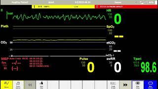 Anesthesia Scenario