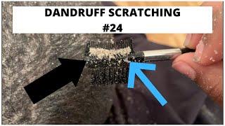 Dandruff scratching #24