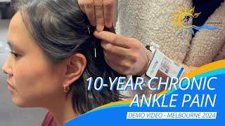 10 Year Chronic Ankle Pain #譚針 #韓玉齡 #eileenhan #正宗譚針 #DrTanBalanceMethodAcupuncture #footpain