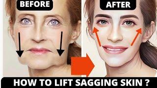  SIMPLE STEP TO LIFT SAGGING SKIN, JOWLS, ANTI-AGING, CHEEKS LIFT !| LAUGH LINES, FOREHEAD LINES