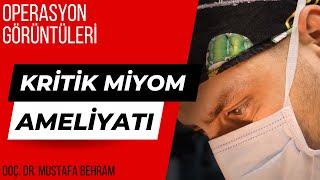 Miyom Ameliyatı Operasyon Görüntüleri | Riskli Hasta için Operasyon Süreci #jinekoloji #jinekolog