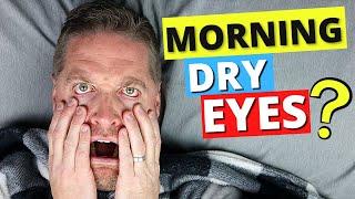 How To Get Rid Of Morning Dry Eyes! - 3 PRO TIPS