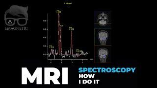 MR SPECTROSCOPY – “HOW I DO IT”