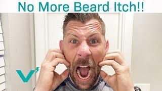 How To Fix The BEARD ITCH!!