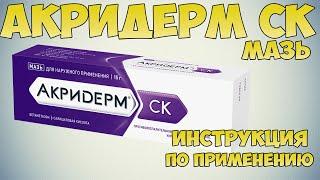 ACRIDERM SK OINTMENT INSTRUCTIONS, TREATMENT OF ECZEMA, PSORIASIS, DERMATITIS, NEURODERMITIS