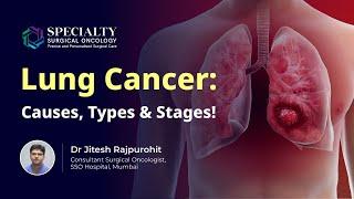 Lung Cancer Basics: Types, Symptoms, and Stages Explained by Dr Jitesh Rajpurohit, SSO