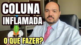 QUAIS PRIMEIROS SINTOMAS QUE A COLUNA ESTÁ INFLAMADA? Como é o TRATAMENTO?