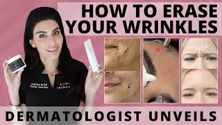 Dermatologist Unveils How to Treat & Prevent Wrinkles | #wrinkles #azimdskincare #skincaretips