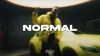 Anas x Soolking Type Beat - “Normal”