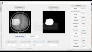 Ieee projects on matlab