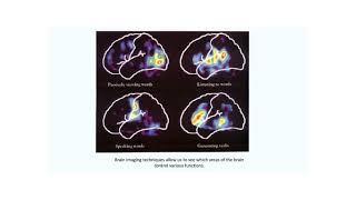 Cognitive Skills and Second or Other Language Acquisition