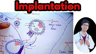 Implantation of Blastocyst|Implantation bleeding vs periods|Implantation symptoms in hindi/urdu