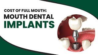 Cost of Full Mouth: Mouth Dental Implants