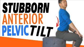 The Simple Fix for Anterior Pelvic Tilt