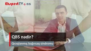 Qıcıqlanmış bağırsaq sindromu nədir?