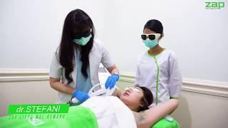 Cara menghilangkan bulu ketiak menggunakan teknologi modern dengan ZAP Underarm Hair Removal