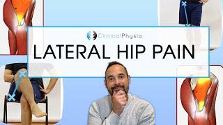 What Causes Lateral Hip Pain? | Expert Physio Reviews Causes And Treatment