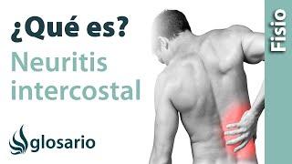 NEURITIS INTERCOSTAL | Qué es, qué estructuras afecta, síntomas, signos, causas y tratamiento