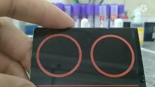 Aso titer test / Aso blood test / Aso latex test ..(hindi)