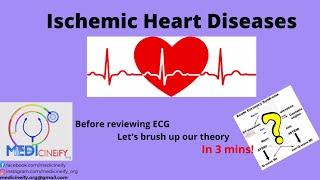 Ischemic Heart Diseases(IHD) classification for ECG.