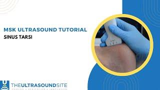 MSK ultrasound evaluation of the Sinus Tarsi