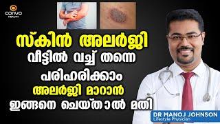 സ്കിൻ അലർജി വീട്ടിൽ വച്ച് തന്നെ പരിഹരിക്കാം അലർജി മാറാൻ ഇങ്ങനെ ചെയ്‌താൽ മതി | Skin Allergy Malayalam