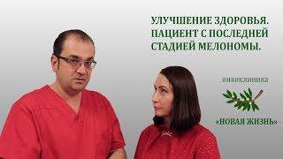 Улучшение здоровья  Пациент с последней стадией меланомы  Онкоклиника Новая Жизнь