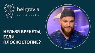  Нельзя брекеты, если плоскостопие?