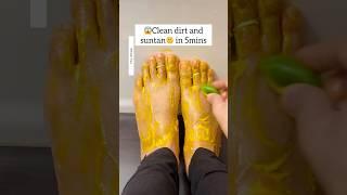 Get Fair Feet Instantly | Most Easy Pedicure At Home/Feet Cleaning Tips, Remove Suntan #diy #shorts