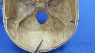 Interior of cranial cavity.....Posterior cranial fossa