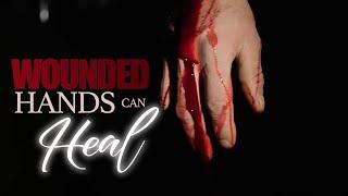 "Wounded Hands Can Heal" - Bishop Jonathan Shaw