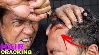 Unlimited Hair Cracking by Asim Barber | Intense Head Massage for Sleep | Back Bone Adjustment ASMR