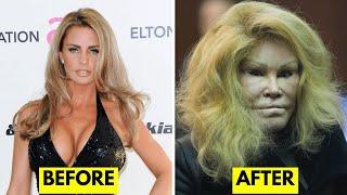 25 Celebrities Before and After Plastic Surgery