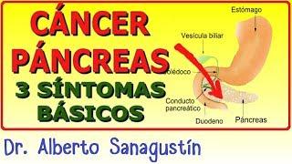 3 Síntomas del CÁNCER DE PÁNCREAS