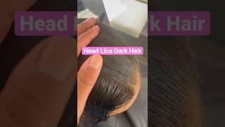 Head lice in dark hair l Lice removal service #explore #lice #liceremoval #hair