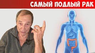 Казус толстого кишечника. Это Самый Подлый Рак! Почему и Как Предотвратить?