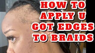 HOW TO COVER BALD SPOTS or NO EDGES • U GOT EDGES x BRAIDS | Severe Alopecia | Instant Edges