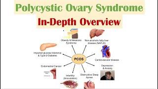 Polycystic Ovary Syndrome (PCOS) | Overview of Associated Conditions, Diagnosis & Treatments
