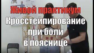 Кросстейпирование при боли в пояснице с самодиагностикой