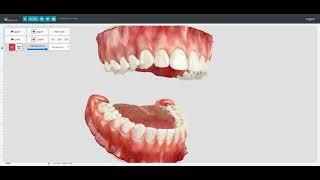 DentalMaster Introduces Revolutionary Cloud-Based 3D Interactive Technology for Planning & Education