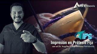 ►Toma de Impresión en Prótesis Fija | Dr. Augusto Bibiano Fernández