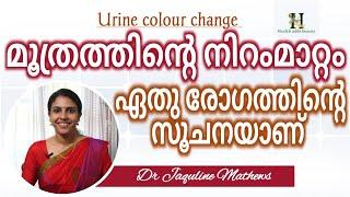 Urine colour change | ചില രോഗങ്ങൾ മൂത്രത്തിന്റെ നിറംകൊണ്ട് മനസിലാക്കാം | Dr Jaquline Mathews BAMS