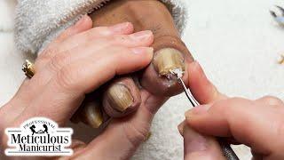 Pedicure Tutorial: How to Relieve Pain in Your Toenails