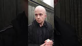Bald nonce full sting