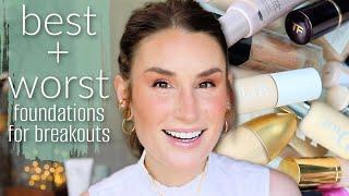 BEST & WORST FOUNDATIONS FOR SENSITIVE & ACNE PRONE SKIN (with Spreadsheet!)