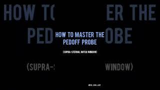 How to master the Pedof probe! (SSN window)! 🫀