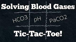 Acid Base Arterial Blood Gas (ABG) Interpretation Made Easy w/ Tic-Tac-Toe! Quick & EZ [Episode 13]