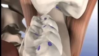 Articulating paper to adjust occlusion; 2 step technique